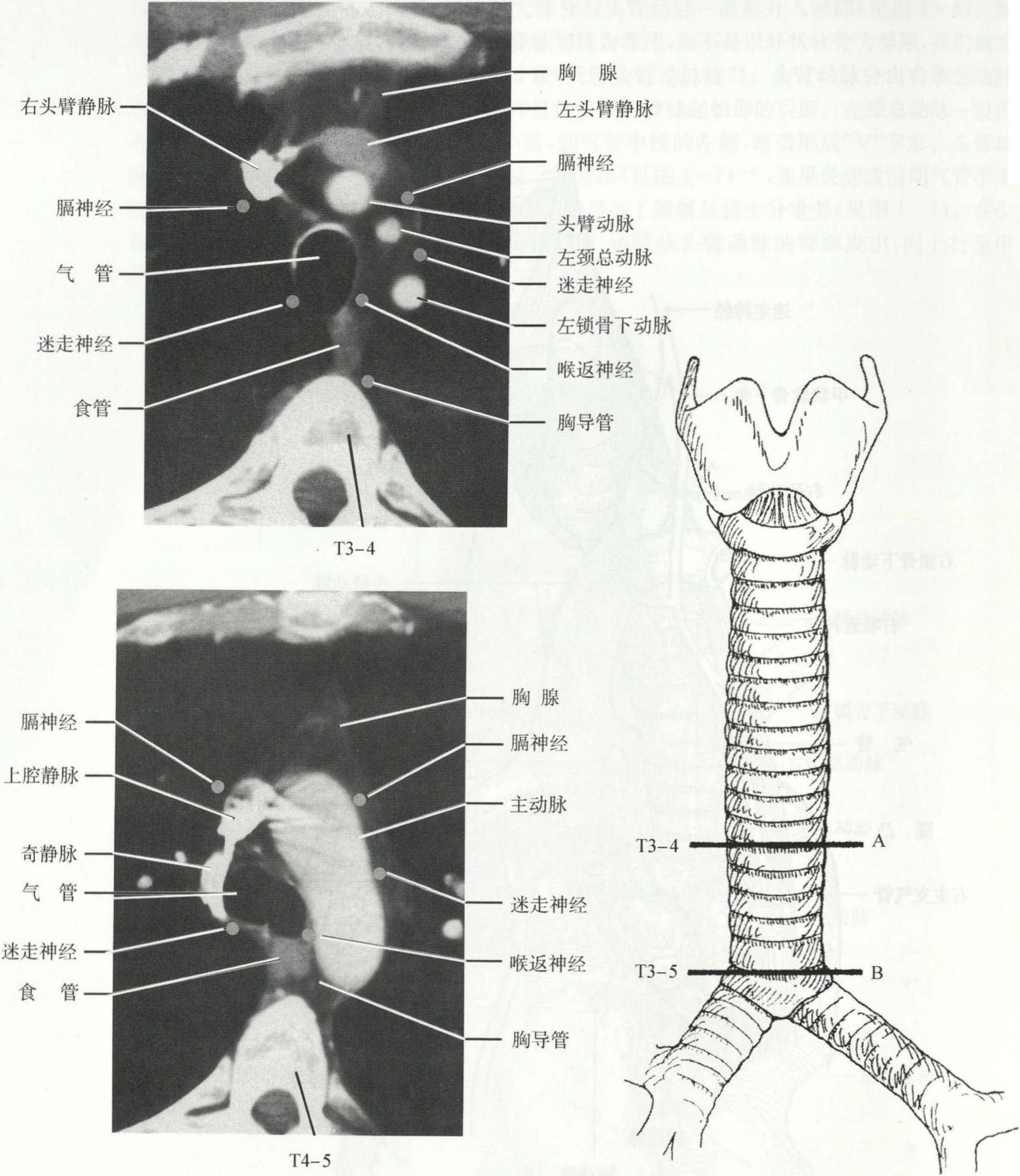 1.2 解剖關(guān)系